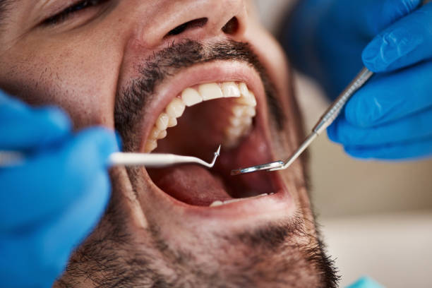 Best Full Mouth Reconstruction  in Exandria, AL